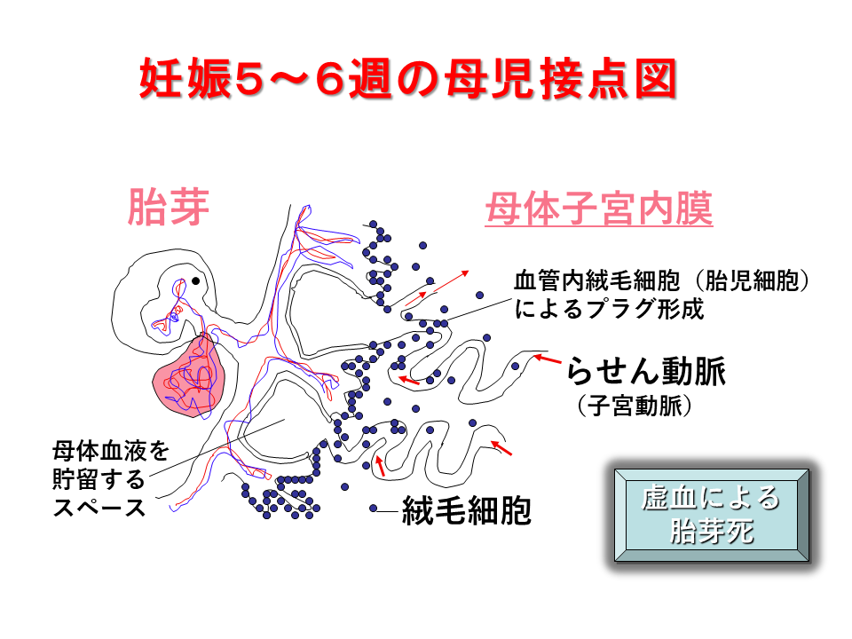 背景と原因 青木産婦人科クリニック 不育症 着床障害